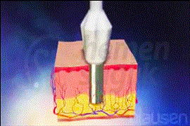 punch-2 270-180 gıf.gif